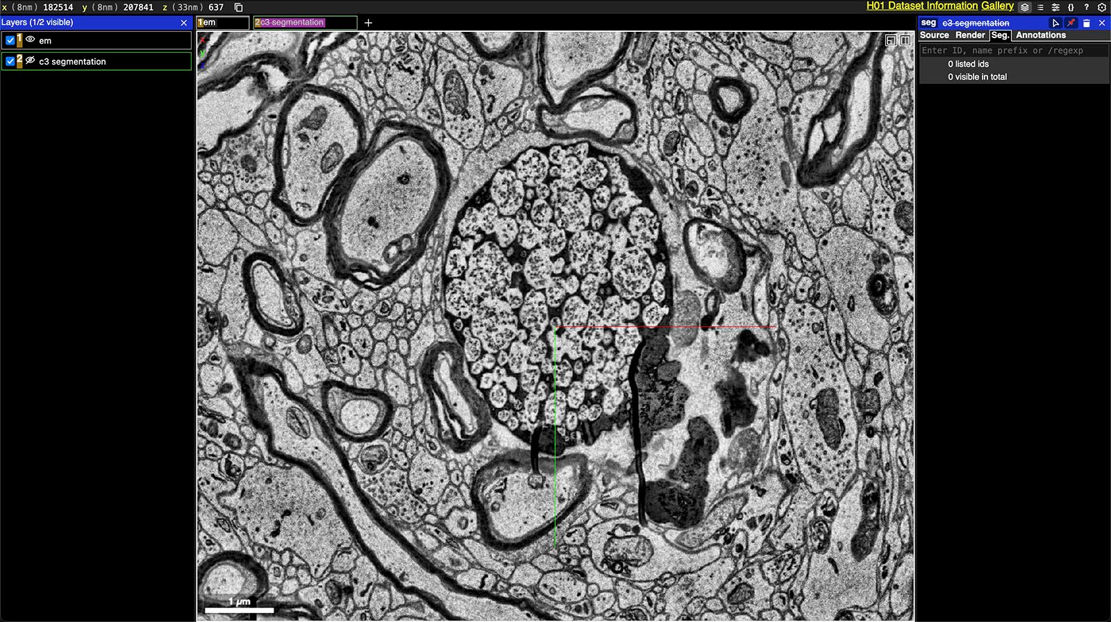 Electron micrograph showing intricate details of cell structures, with focus on specific cell indicated by red markers.  A scale bar is available for size reference.