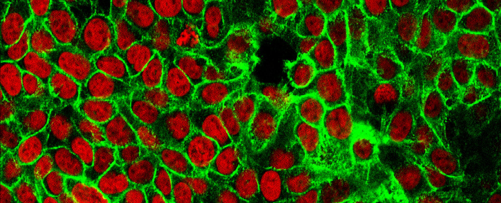 You are currently viewing Researchers discover cancer ‘fingerprints’ using geological technique