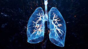 Read more about the article A new drug being tested offers breathing room for patients with a deadly lung disease