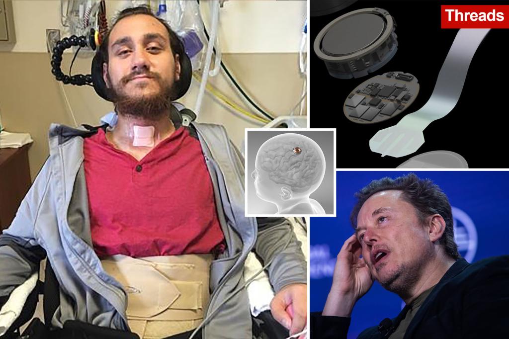 Read more about the article Elon Musk’s Neuralink chip malfunctions in first human brain implant