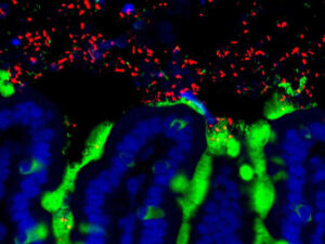 Read more about the article Gut microbiota composition may influence decision making