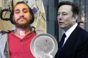 Read more about the article How Elon Musk’s Neuralink brain chip lets paralyzed people control devices with their minds