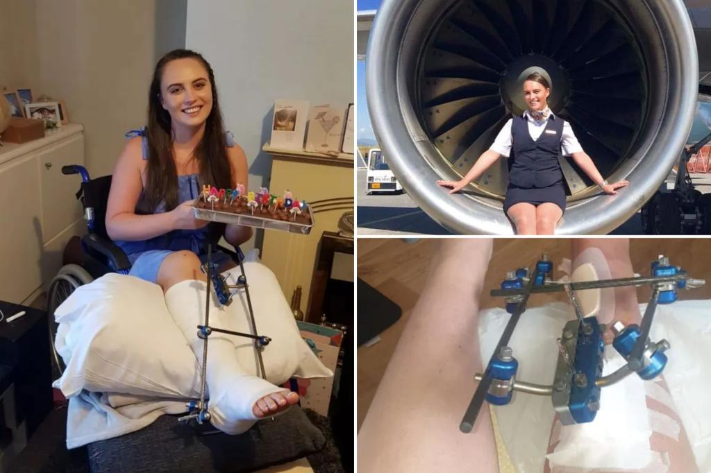 Read more about the article I’m a flight attendant – I broke my leg in seven places due to extreme turbulence