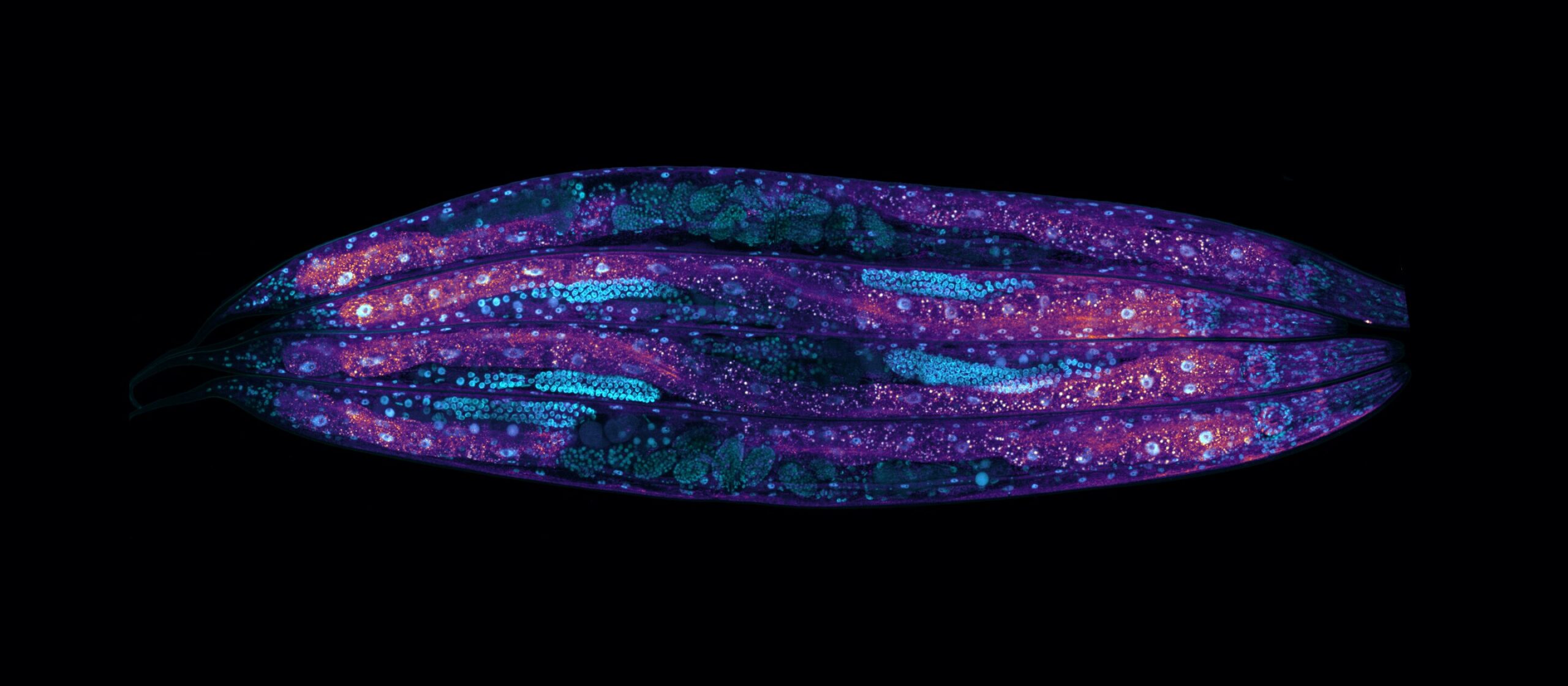 You are currently viewing The C. elegans study found that the balance of mRNA in cells affects lifespan