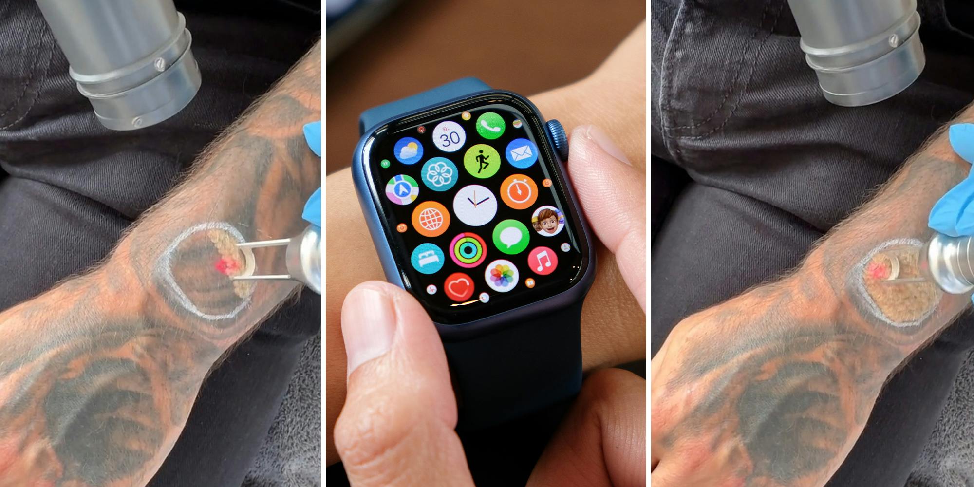 Read more about the article ‘My Apple Watch kept locking up’: Man gets tattoo removed so Apple Watch can work properly  Can a tattoo really block the Apple Watch?