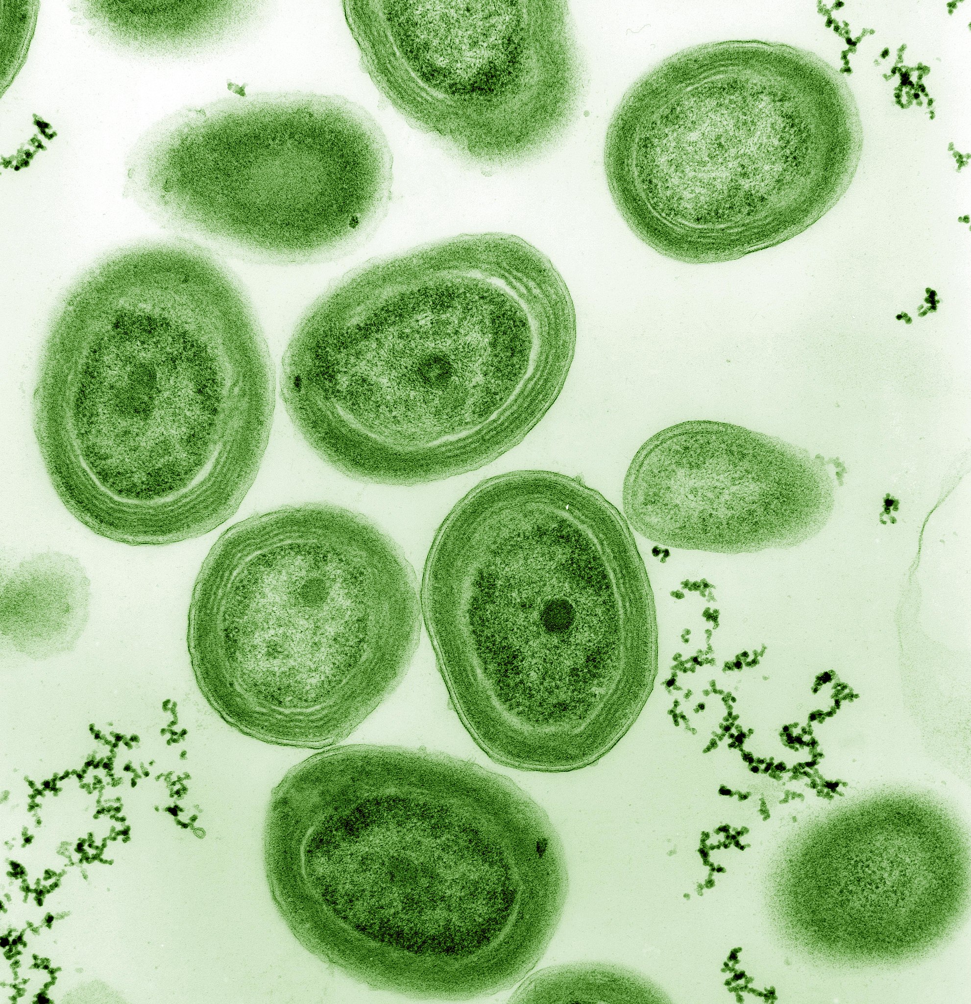 cyanobacteria