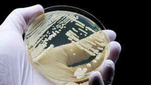 Read more about the article A new fungal infection has been discovered in China